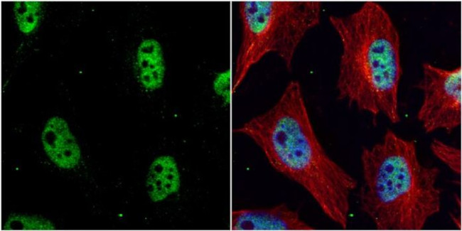 Chk1 Antibody in Immunocytochemistry (ICC/IF)