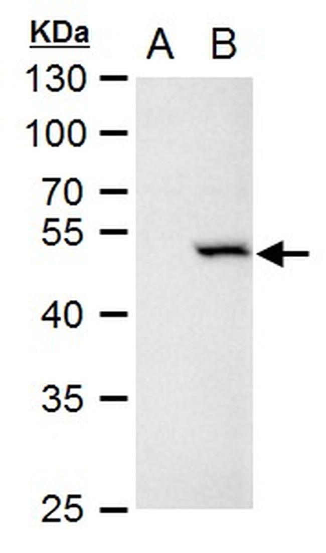 Chk1 Antibody in Western Blot (WB)