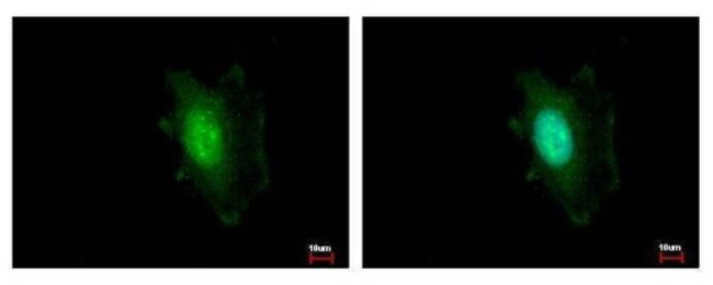 DDB1 Antibody in Immunocytochemistry (ICC/IF)