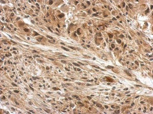 DDB1 Antibody in Immunohistochemistry (Paraffin) (IHC (P))