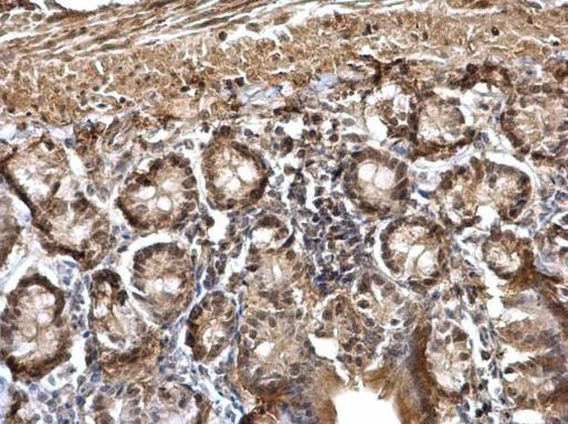 DDB1 Antibody in Immunohistochemistry (Paraffin) (IHC (P))