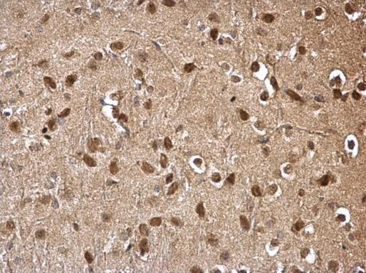 DDB1 Antibody in Immunohistochemistry (Paraffin) (IHC (P))