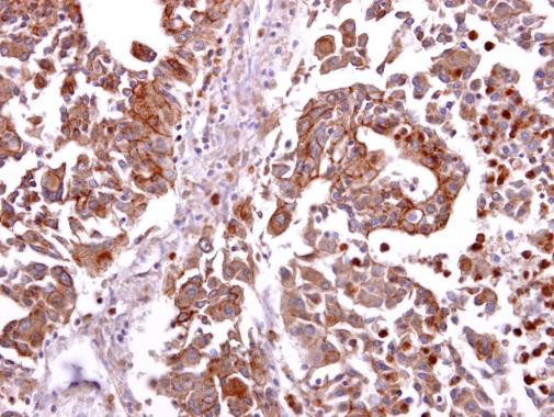 CCR8 Antibody in Immunohistochemistry (Paraffin) (IHC (P))