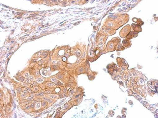 CCR8 Antibody in Immunohistochemistry (Paraffin) (IHC (P))