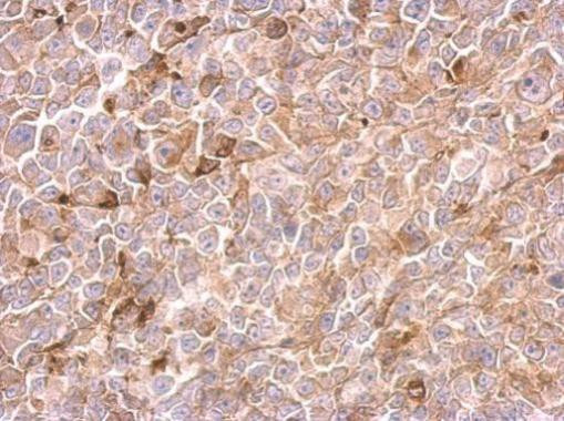 Urokinase Antibody in Immunohistochemistry (Paraffin) (IHC (P))