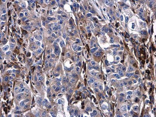 Urokinase Antibody in Immunohistochemistry (Paraffin) (IHC (P))