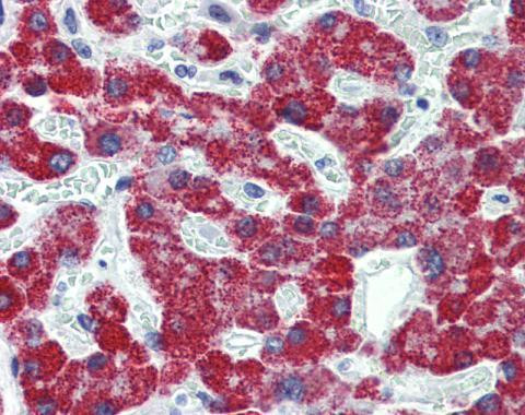 ACADS Antibody in Immunohistochemistry (Paraffin) (IHC (P))