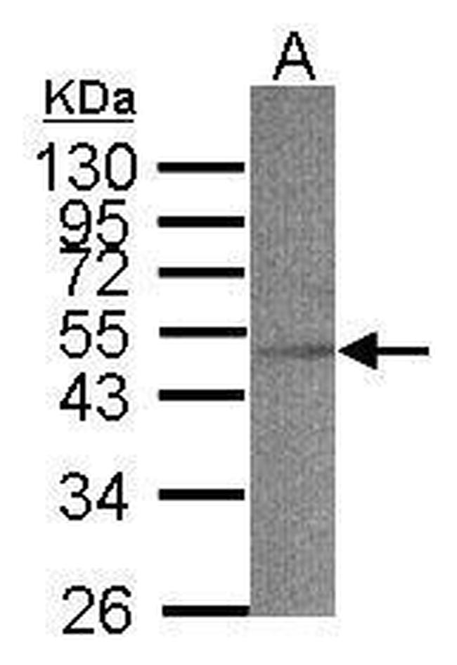 ACADS Antibody in Western Blot (WB)