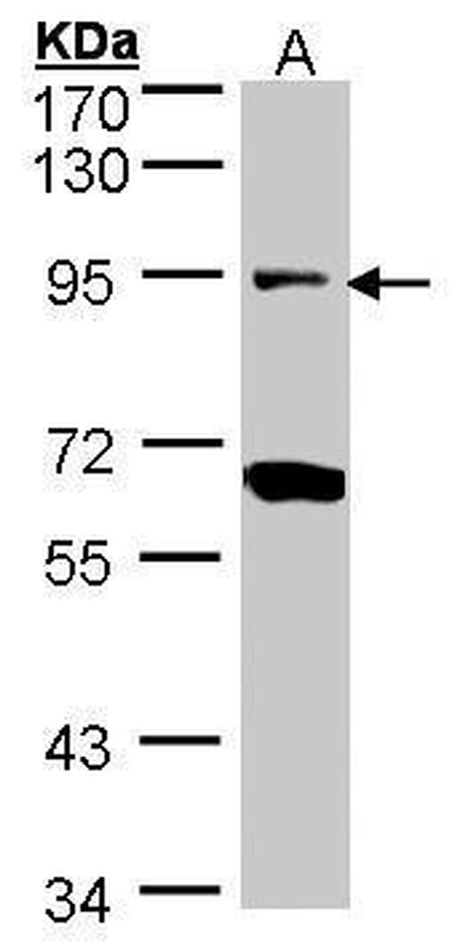 Periostin Antibody in Western Blot (WB)