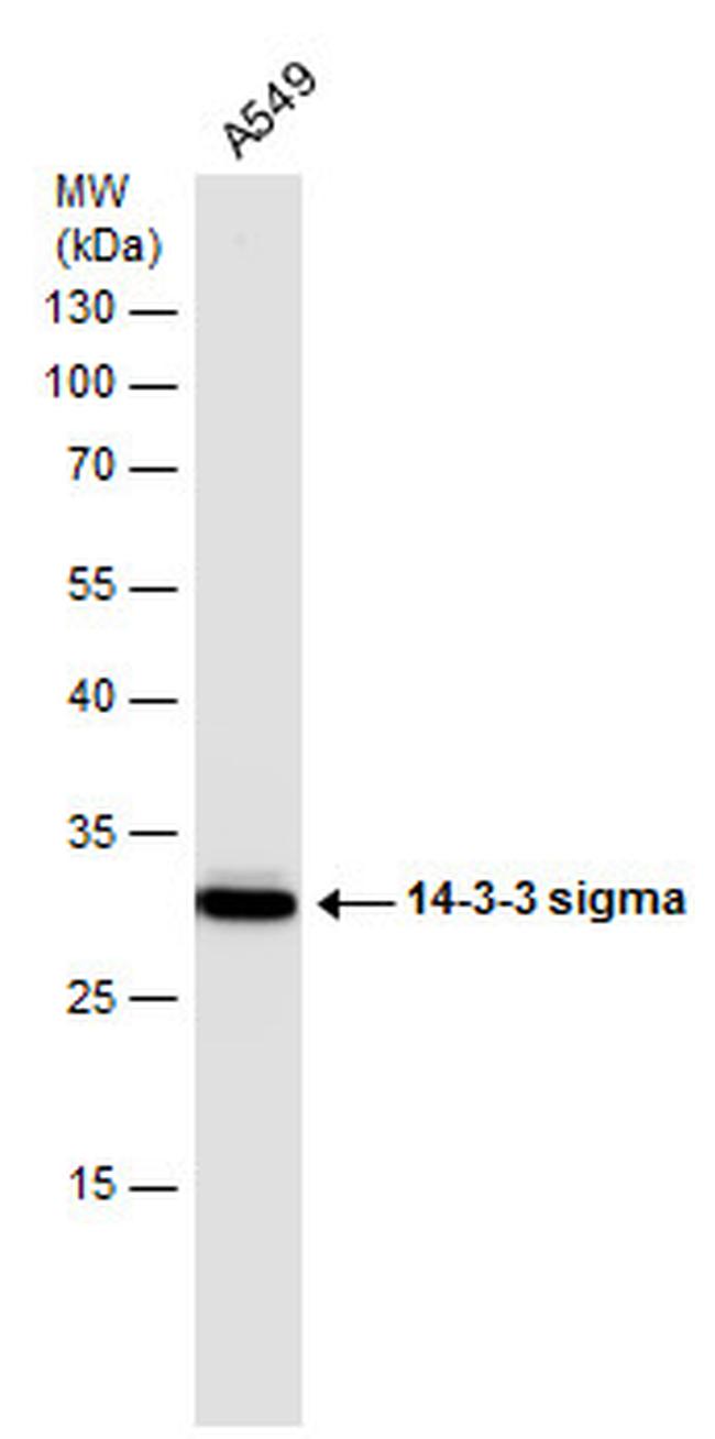 14-3-3 sigma Antibody in Western Blot (WB)