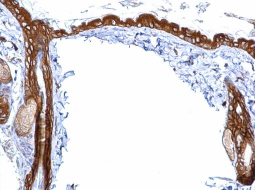 14-3-3 sigma Antibody in Immunohistochemistry (Paraffin) (IHC (P))