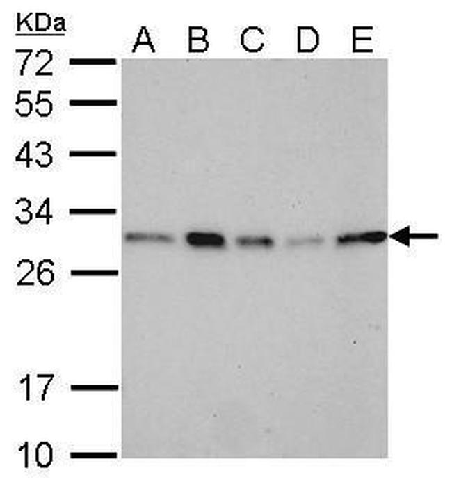 14-3-3 sigma Antibody in Western Blot (WB)