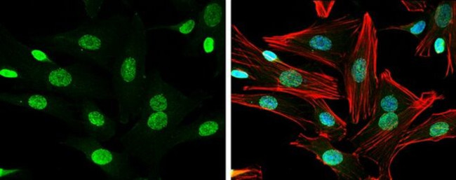 NRG1 Antibody in Immunocytochemistry (ICC/IF)