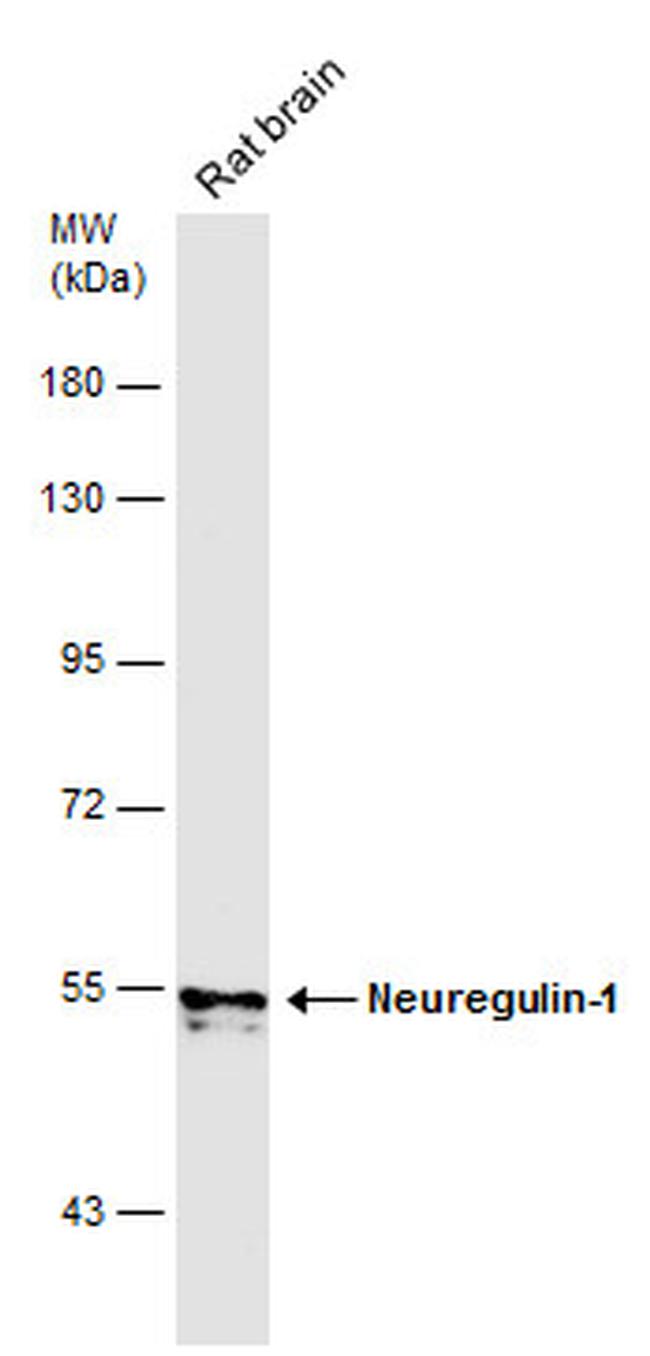 NRG1 Antibody in Western Blot (WB)