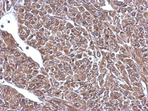 NEFL Antibody in Immunohistochemistry (Paraffin) (IHC (P))