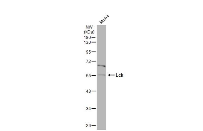 LCK Antibody in Western Blot (WB)