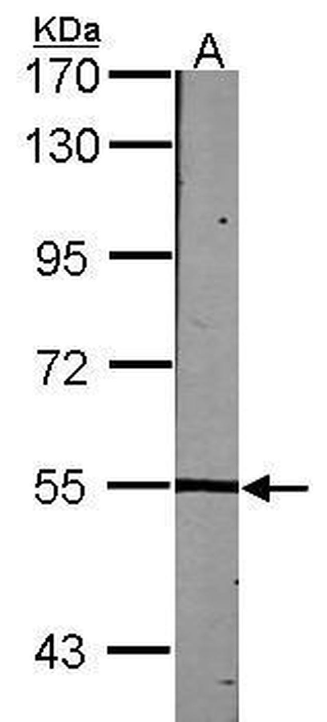 LCK Antibody in Western Blot (WB)