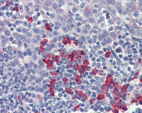 Amyloid Precursor Protein Antibody in Immunohistochemistry (Paraffin) (IHC (P))