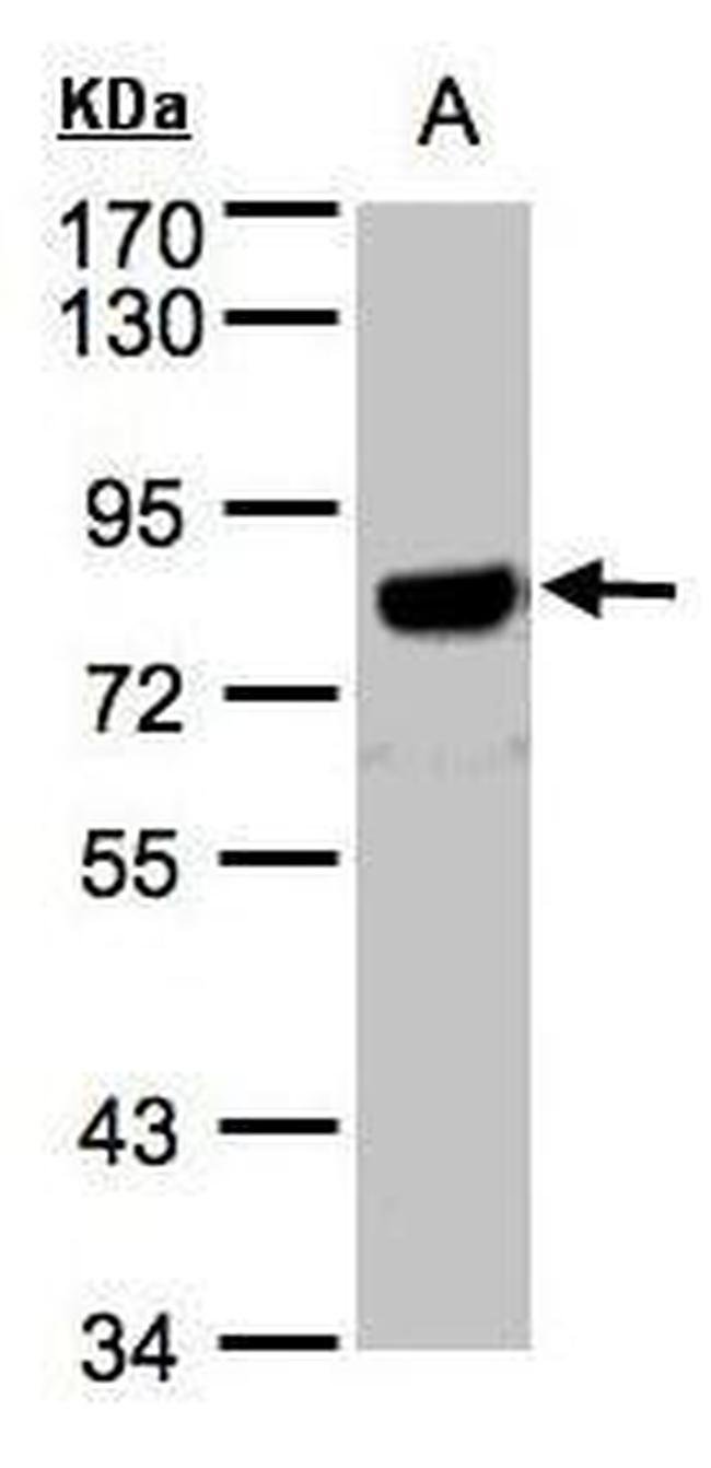 Amyloid Precursor Protein Antibody in Western Blot (WB)