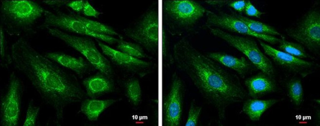 Amyloid Precursor Protein Antibody in Immunocytochemistry (ICC/IF)