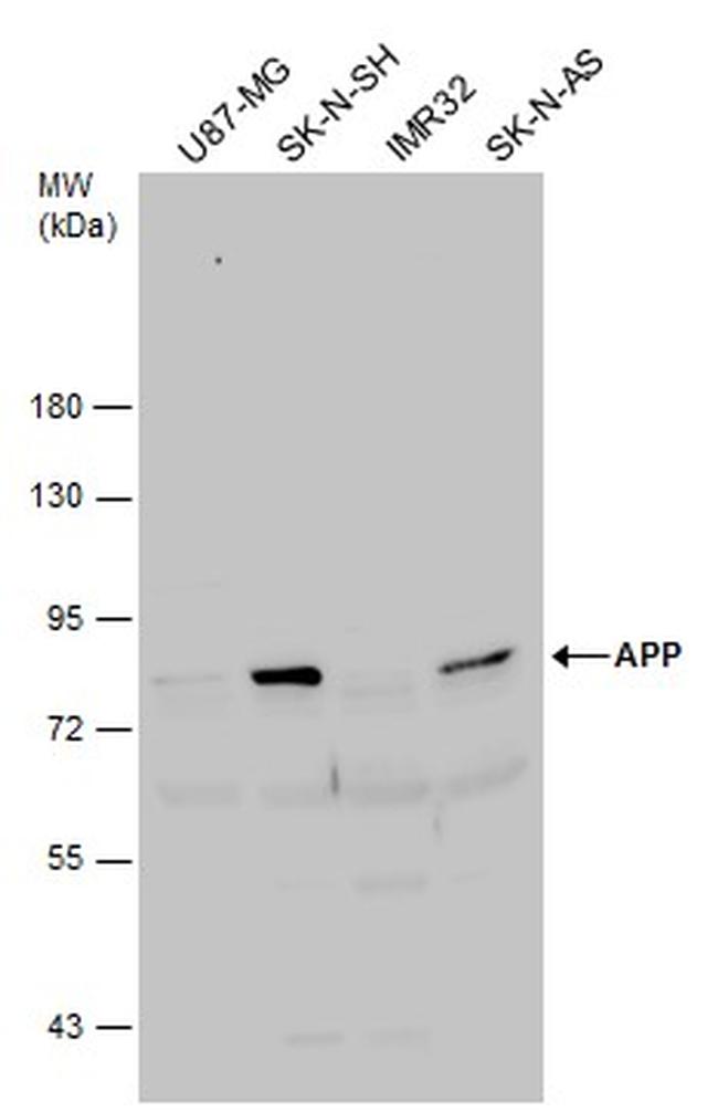 Amyloid Precursor Protein Antibody in Western Blot (WB)