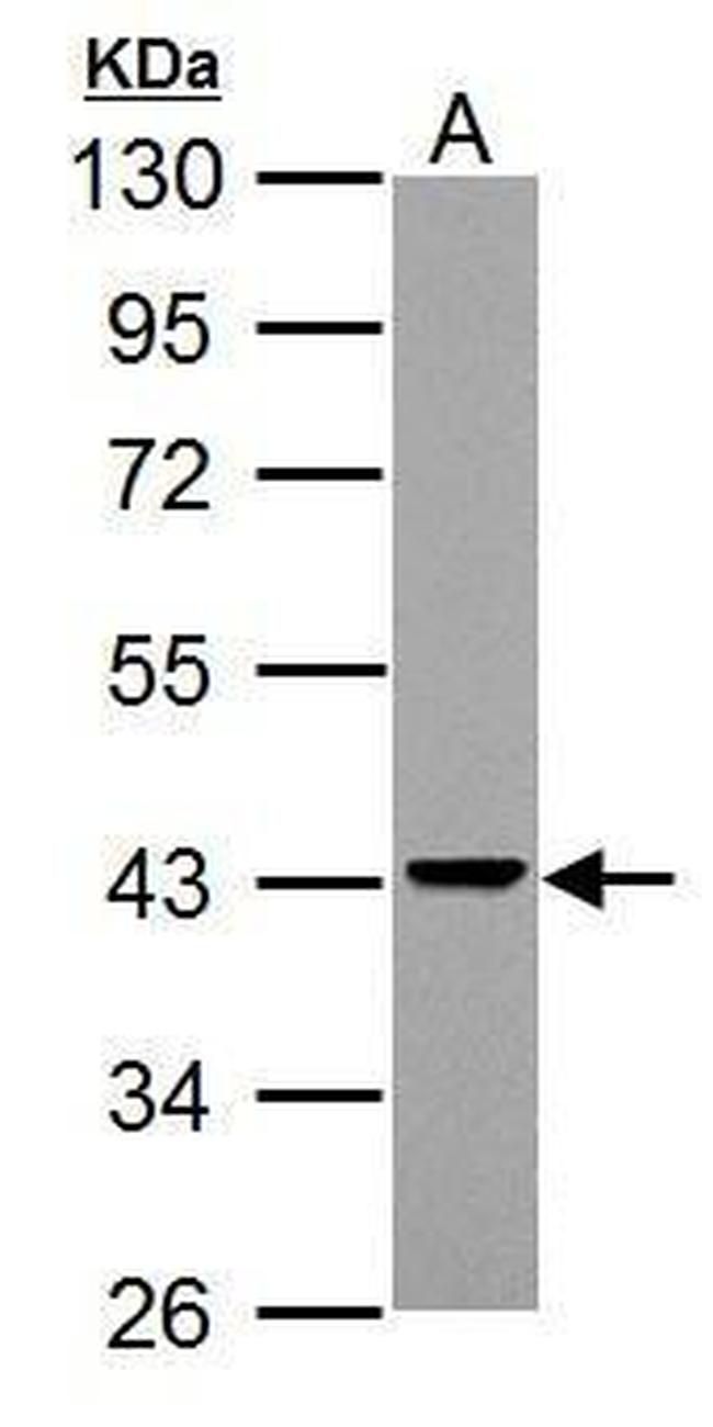 Adenosine Deaminase Antibody in Western Blot (WB)