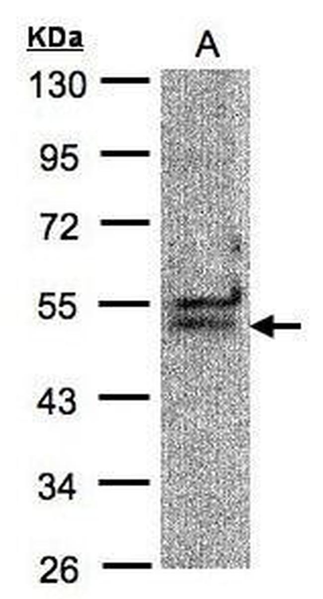 UAP56 Antibody in Western Blot (WB)