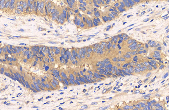 mTOR Antibody in Immunohistochemistry (Paraffin) (IHC (P))