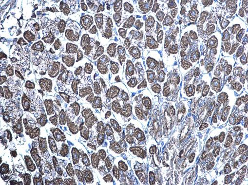 mTOR Antibody in Immunohistochemistry (Paraffin) (IHC (P))