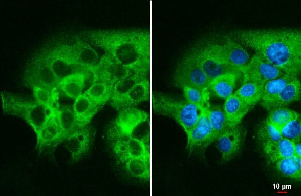 mTOR Antibody in Immunocytochemistry (ICC/IF)