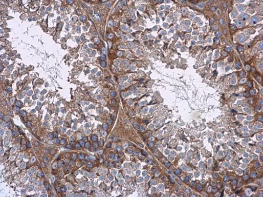 mTOR Antibody in Immunohistochemistry (Paraffin) (IHC (P))