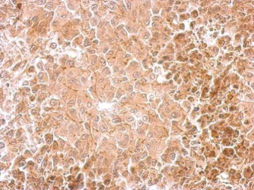 Dopamine beta Hydroxylase Antibody in Immunohistochemistry (Paraffin) (IHC (P))