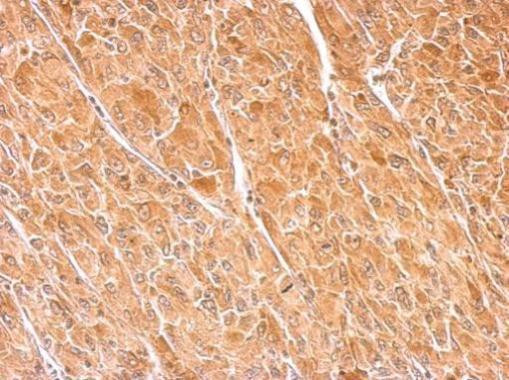 Dopamine beta Hydroxylase Antibody in Immunohistochemistry (Paraffin) (IHC (P))