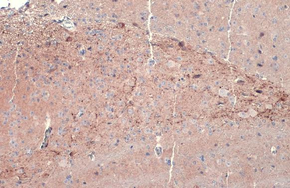 Dopamine beta Hydroxylase Antibody in Immunohistochemistry (Paraffin) (IHC (P))