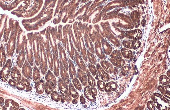 Calnexin Antibody in Immunohistochemistry (Paraffin) (IHC (P))