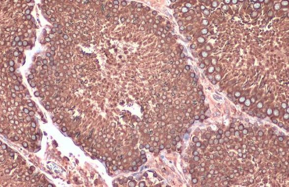 Calnexin Antibody in Immunohistochemistry (Paraffin) (IHC (P))