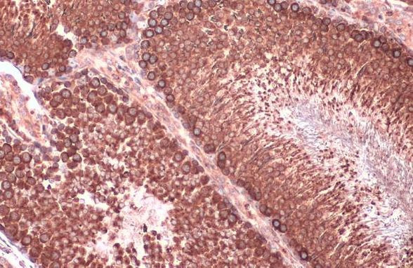 Calnexin Antibody in Immunohistochemistry (Paraffin) (IHC (P))