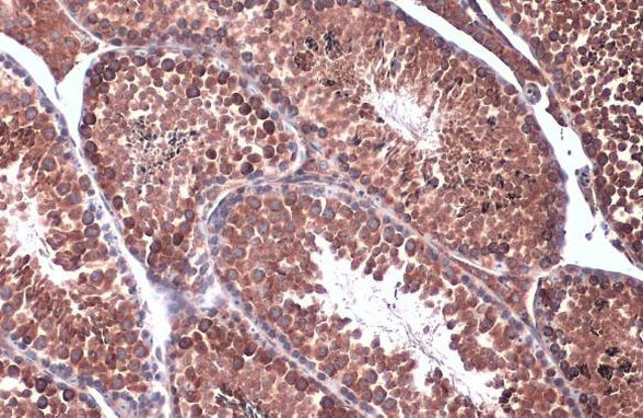 Calnexin Antibody in Immunohistochemistry (Paraffin) (IHC (P))