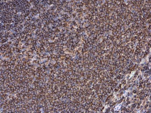 Moesin Antibody in Immunohistochemistry (Paraffin) (IHC (P))