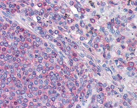 gamma Actin Antibody in Immunohistochemistry (Paraffin) (IHC (P))