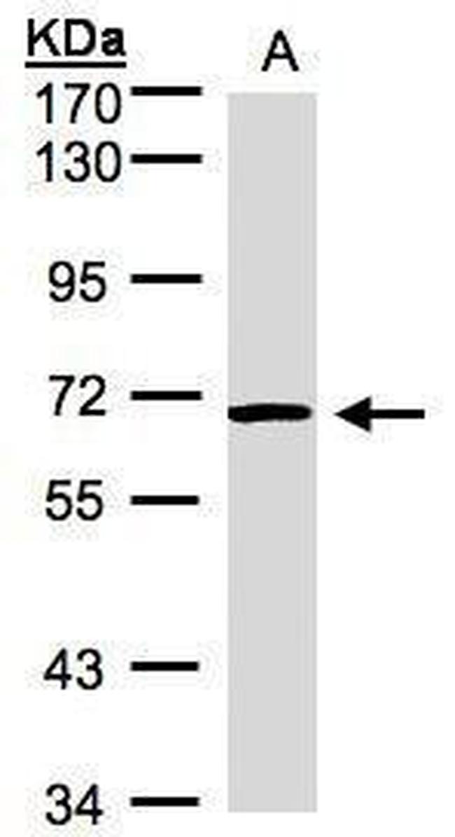 ACVRL1 Antibody in Western Blot (WB)