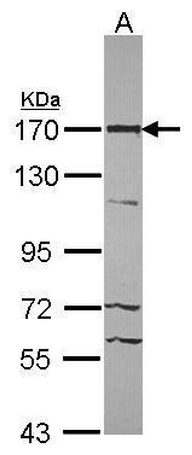 53BP2 Antibody in Western Blot (WB)
