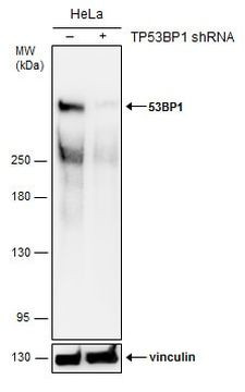 53BP1 Antibody