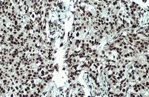 53BP1 Antibody in Immunohistochemistry (Paraffin) (IHC (P))