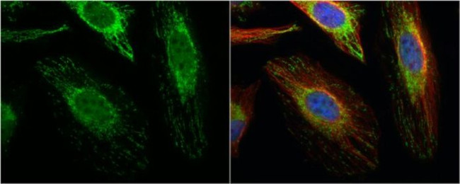 ACAT1 Antibody in Immunocytochemistry (ICC/IF)