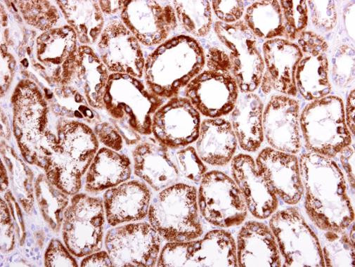 ACAT1 Antibody in Immunohistochemistry (Paraffin) (IHC (P))