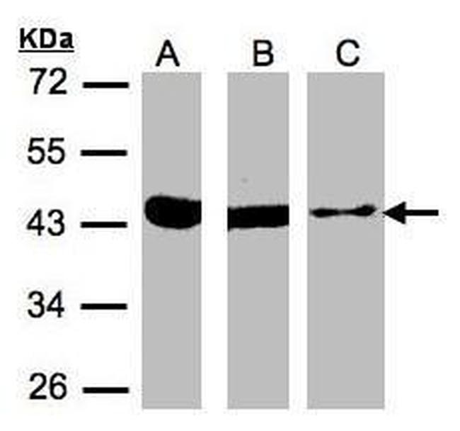 ACAT1 Antibody in Western Blot (WB)