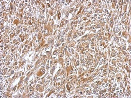 Plasminogen Antibody in Immunohistochemistry (Paraffin) (IHC (P))