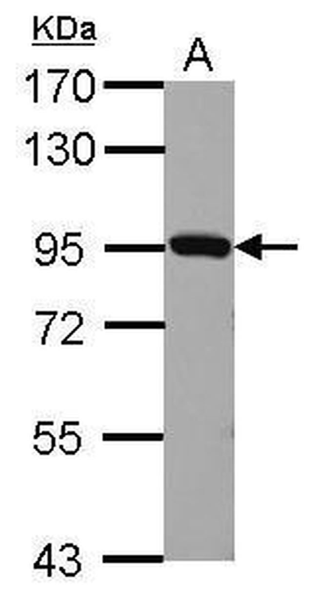 Plasminogen Antibody in Western Blot (WB)