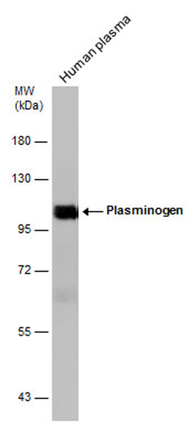 Plasminogen Antibody in Western Blot (WB)